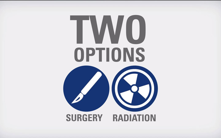 Behandlungsoptionen bei Prostatakrebs